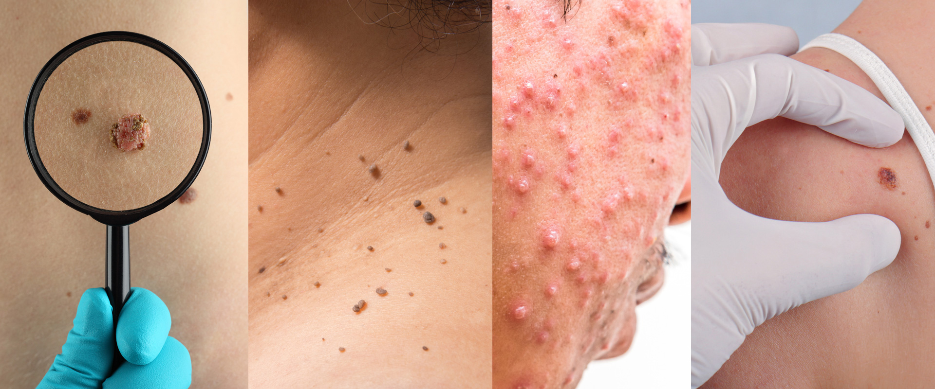 Dermatología | Cuidado de la Piel